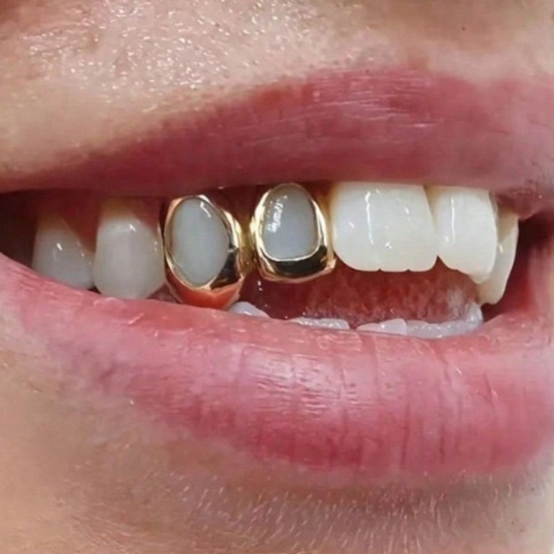 طقم مجوهرات أسنان جولدن جريلز  - مراجعة Body Jewelry Changing Kit وسعره